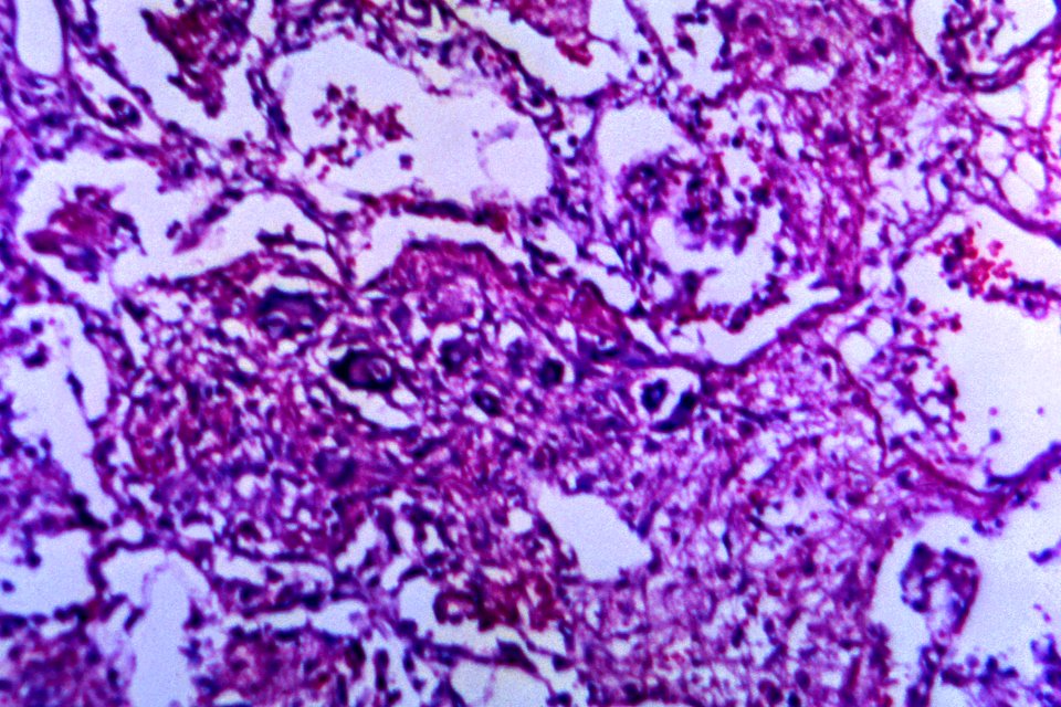 A 125X Photomicrograph Magnification Of A Hematoxylin And Eosin H E