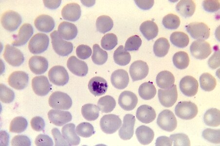 Microscope plasmodium specie