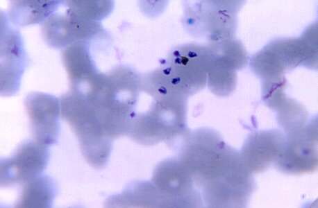 Blood cervical smear number photo