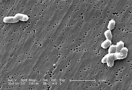 Causing salmonella salmonellosis photo