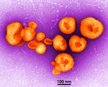 Arenavirus genus member photo