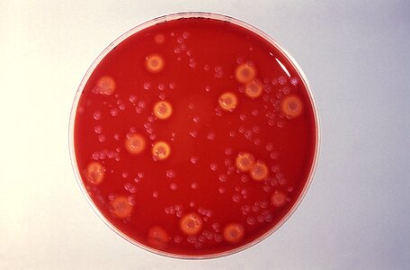 Blood blood agar bottom
