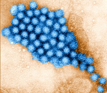 Morphology ultrastructural virus photo