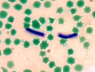 Bacillus blood capsule photo