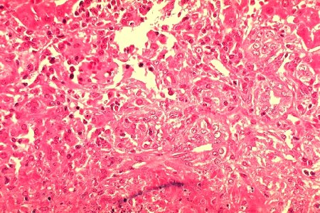 Guinea Pig Gvineja histopathology