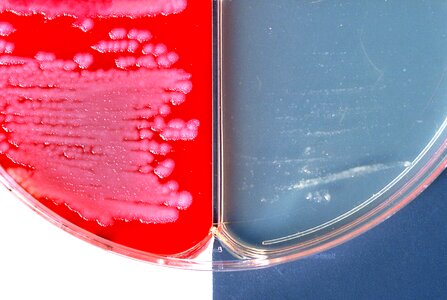 Bacillus encapsulation evidence photo