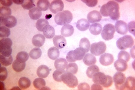 Blood cervical smear form