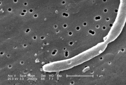 Bacteria details escherichia photo