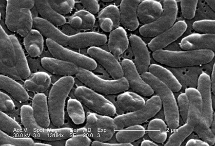 Bacteria grouping vibrio photo