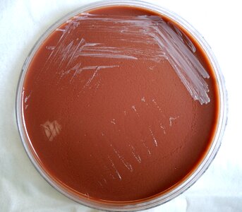 Abortus bacteria chocolate photo