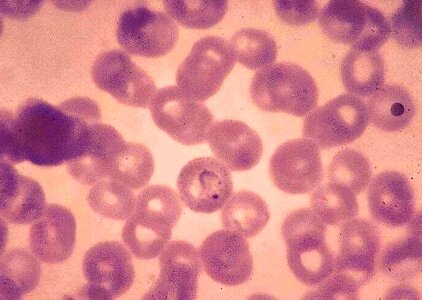 Form plasmodium ring
