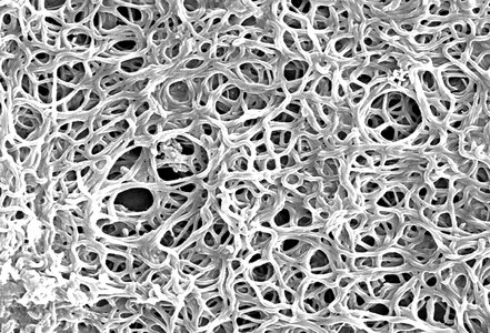 Bacteria  