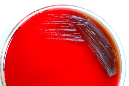 Abortus bacteria blood