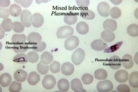 Film infection 