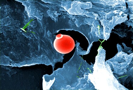 Microorganism round photo