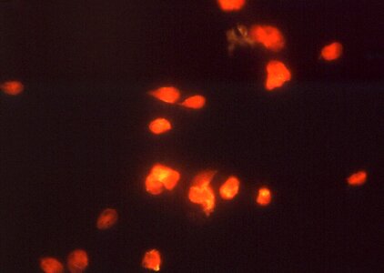 Giardia giardiasis immunofluorescence photo