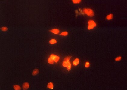 Giardia giardiasis immunofluorescence