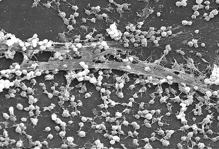 Array bacteria breast photo