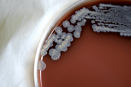 Bacteria colonial gram photo