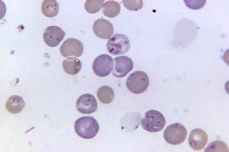 Blood plasmodium photo