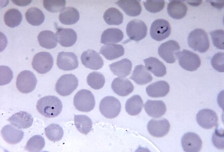Chromatin film form