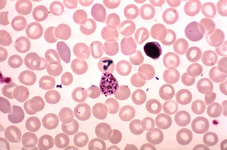Plasmodium scrub 