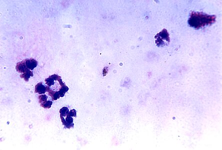 Blood cervical smear gametocyte