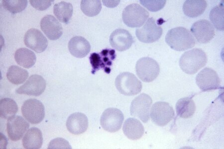 Artifact malaria parasit
