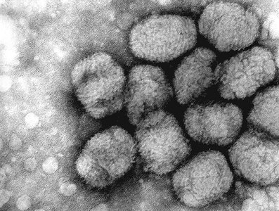Electron electron micrograph smallpox photo