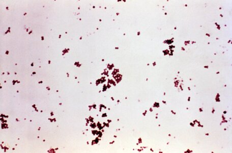 Bacteria gram shock photo