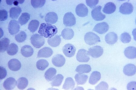 Cytoplasm show 