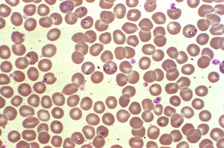 Other plasmodium 