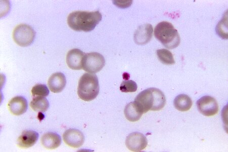 Blood found parasit photo