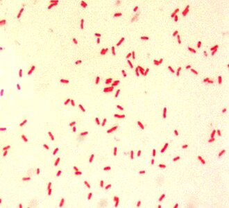 Bacillus gram little photo