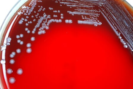 Bacteria colonial gram