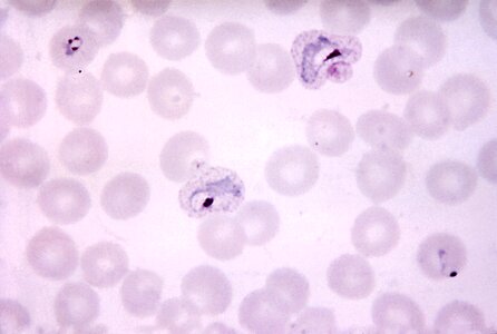 Chromatin crescent ring photo