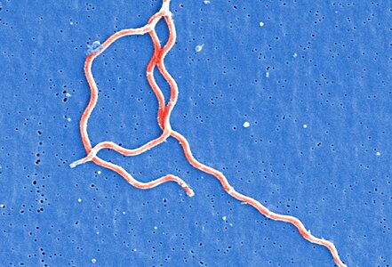 Bacteria Borrelia spirochaetaceae gram photo