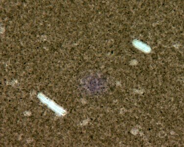 Bacillus capsule scrub photo