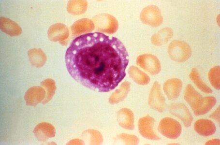 Blood cervical smear found photo