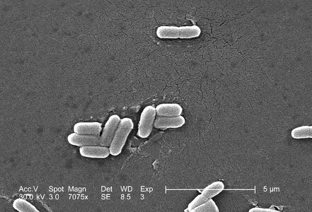 Bacteria electron electron micrograph photo