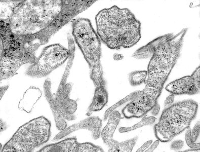 Cell culture details