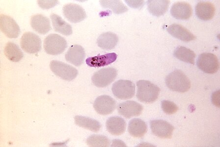 Pigment pinkish plasmodium photo