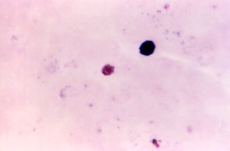 Film gametocyte photomicrograph photo