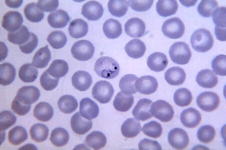 Amount chromatin cytoplasm