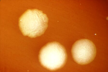 Bacteria clostridium family photo