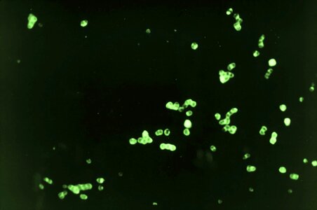 Bacteria gram negative photo