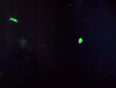 Cervical Smear impression photomicrograph