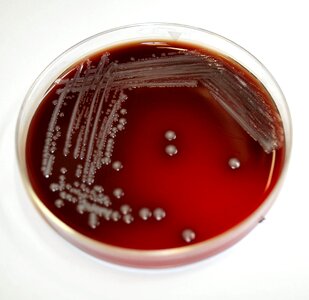 Bacteria blood agar gram photo