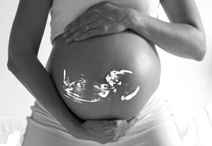 Ultrasound pregnancy belly photo