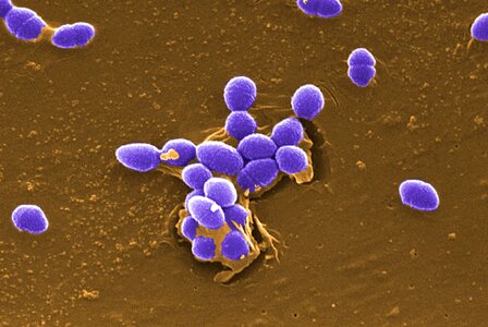 Bacteria gram positive photo